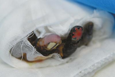 13岁少年抢手机泼汽油烧伤女子 放回家铁链拴(图)