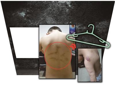 南京一幼儿园老师用晾衣架打孩子被拘留(图)