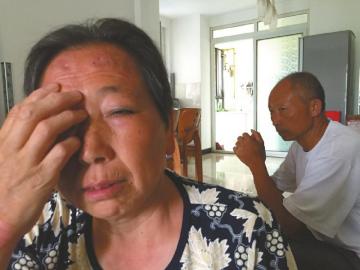 ѦӢ����ʧȥ��������ȫ��һ��Īչ��