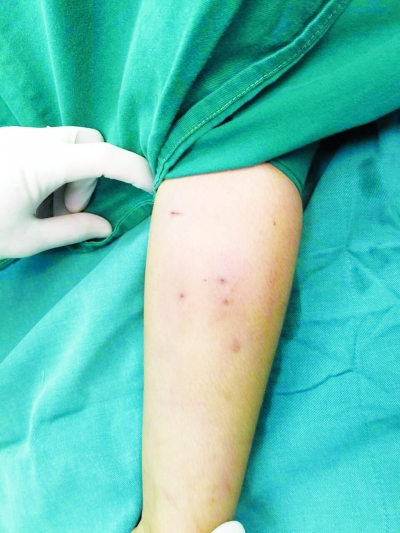 13��Ů���ֱ�����16��Ǧ��о ���ˣ�����ѧϰѹ����