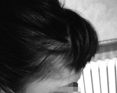 女生寝室遭同学围殴嘴被撕裂 打人者称对警车免疫 女生寝室遭同学围殴嘴被撕裂 打人者称对警车免疫